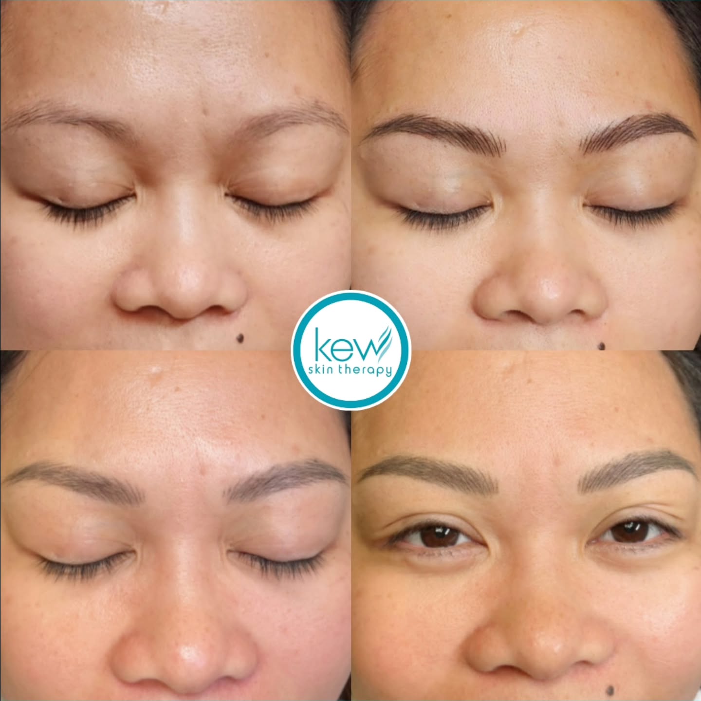 Happy Client = Happy Artist! 😊
We are beyond grateful for trusting us to create your perfect brow transformation. There's no greater reward than seeing you leave with a smile and confidence!
Ready to get your natural brow makeover?
Book your appointment today!
https://www.kewskintherapy.com.au/
Kew Skin Therapy
📍174 High Street, Kew, VIC 3101
📞(03) 9853 4544
#Kewskintherapy
#Nanostrokes
#Ombreshading
#BrowGoals #BrowTransformation #NaturalBrows #HappyClient #BrowArtist #ConfidenceBoost #BeautyWithConfidence #BrowPerfection #BookNow #FlawlessBrows