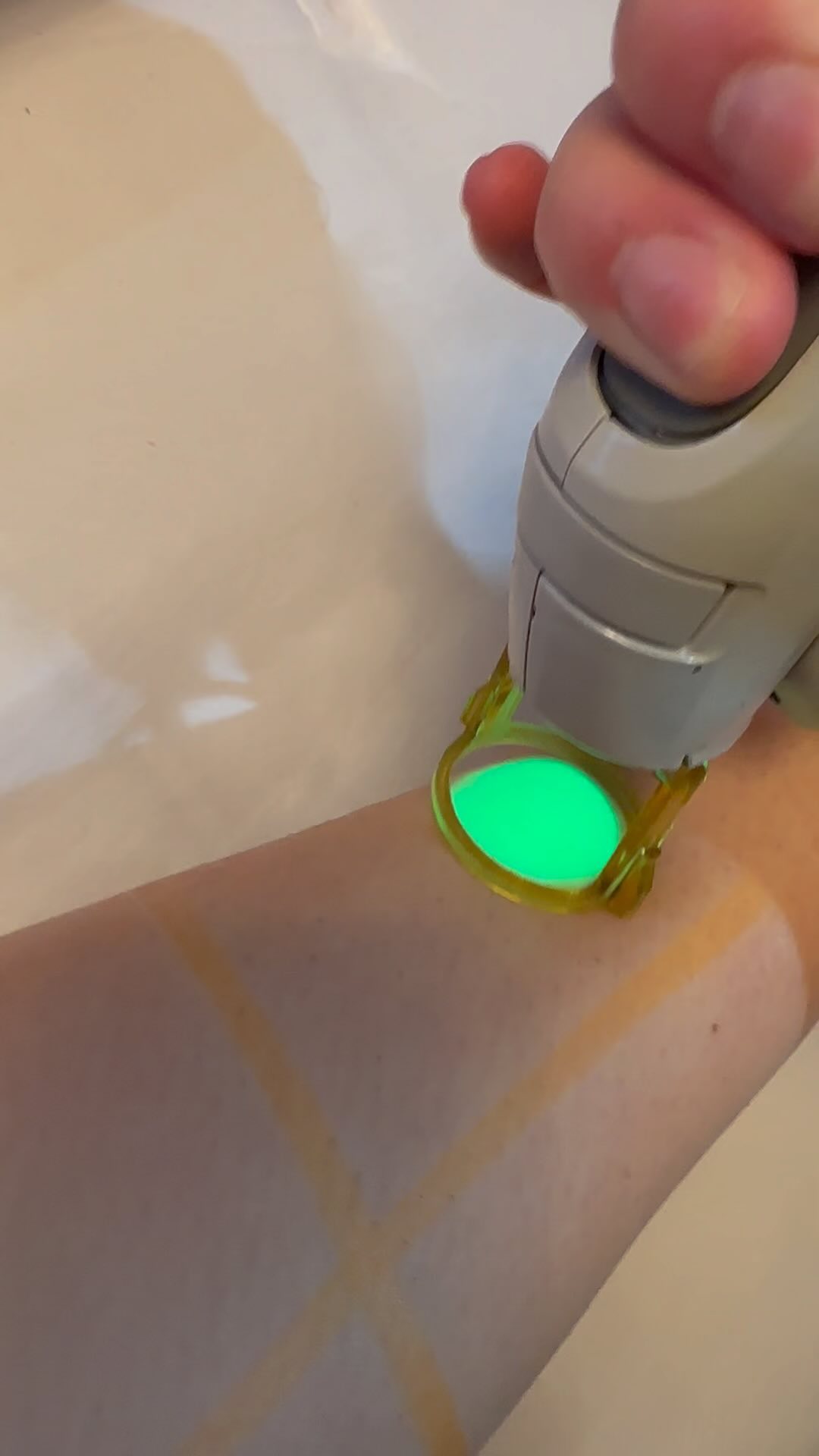 Laser hair removal! 2nd session and client barely shaved!
-
-
-
#laserhairremovaltreatment #reductionhairgrowth #nomoreshaving #beautybloggers