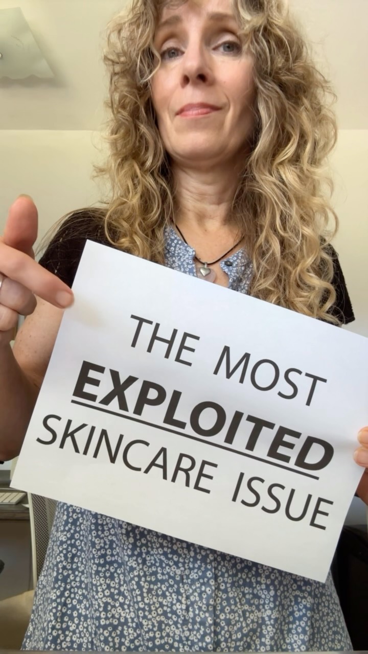 ❌Dandruff shampoos are NOT going to “fix” your dandruff.
🤕They’re a bandaid approach.
👉 I honestly should’ve made this blog into an e-book because it has so much info in it! (but I already have two books on the go 😅)
✅ Learn why dandruff shampoos are a ‘quick-fix’
✅ Understand why you’re dandruff well most likely return
✅ Learn the internal factors that ARE causing your dandruff
✅ … and what to do about them
✅ learn which supplements can help!
THIS is the one you want to share with others!
🔥 obloom.ca
❓ have you ever had dandruff? EVER? What about acne? Did you know there is a connection between the two? 😳
.
.
#dandruff #dandrufftreatment #dandrufffree #dandruffsolution #microbiome #scalphealth #malassezia #acneadvice #scalpmicrobiome #dandruffshampoo #ecohair